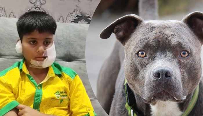 Pitbull attack gaziabad