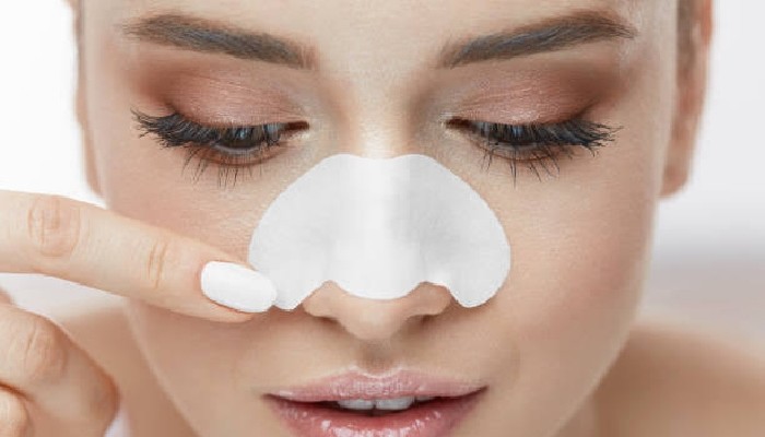 Blackheads